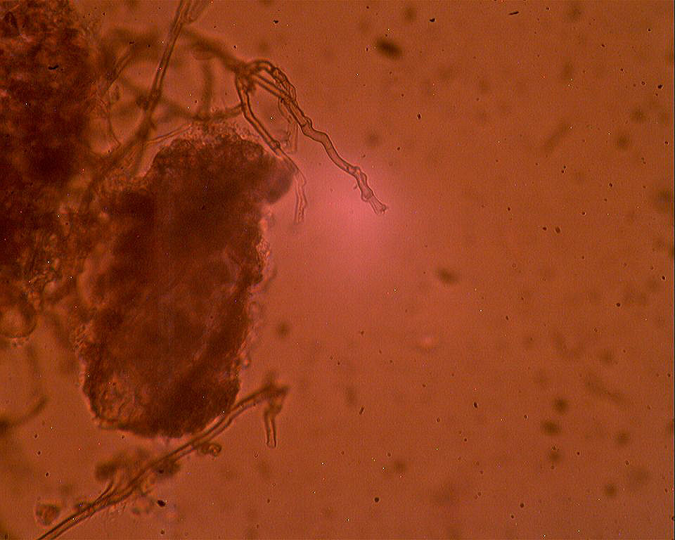 Corticiacea ospitale